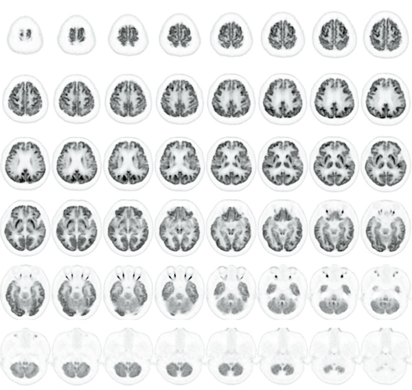 脳のPET横断画像で、細かい構造が明瞭に描出されている