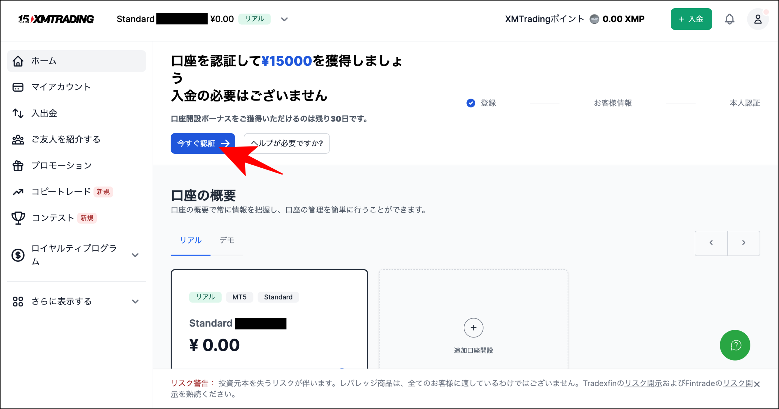 海外FXの口座開設ボーナスを受け取る手順